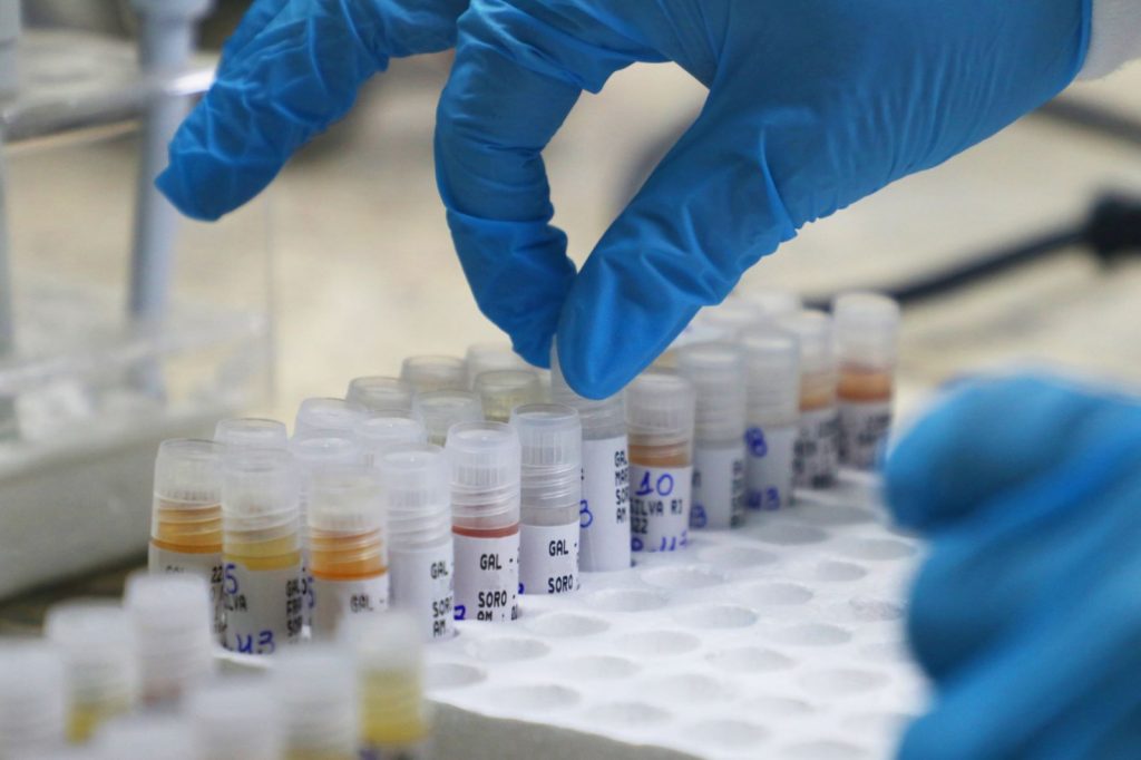 Mpox: Informe semanal atualiza situação da doença no Amazonas, nesta terça-feira Portal Informe Digital WhatsApp Image 2023 03 07 at 17.38.13 1024x682 1