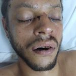 SES AM Joao Lucio pede ajuda para localizar familiares de paciente Foto divulgacao 1 576x1024 wkTmXS